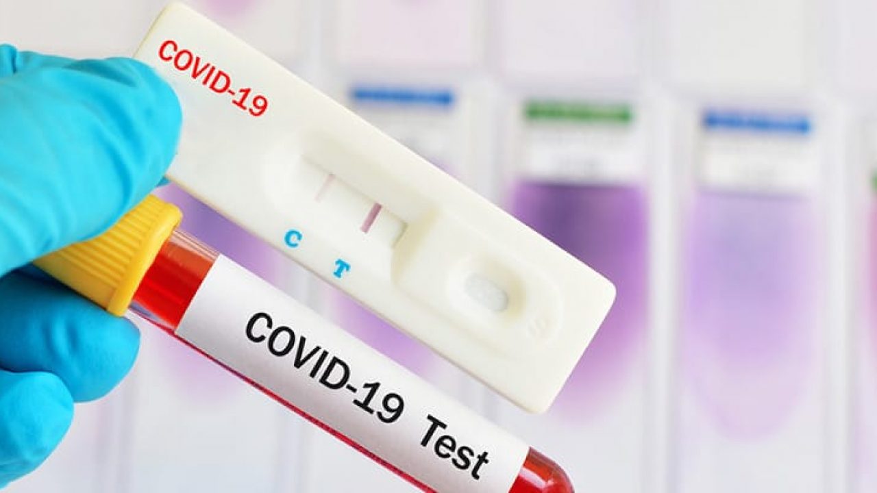 test-coronavirus-1280x720